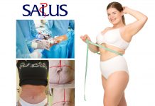 Abdominoplastyka – czym jest i kiedy się na nią zdecydować?