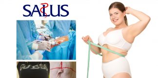 Abdominoplastyka – czym jest i kiedy się na nią zdecydować?