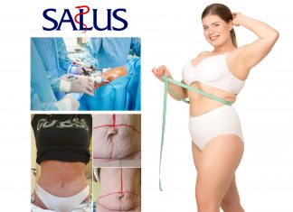 Abdominoplastyka – czym jest i kiedy się na nią zdecydować?